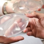 Breast Augmentation