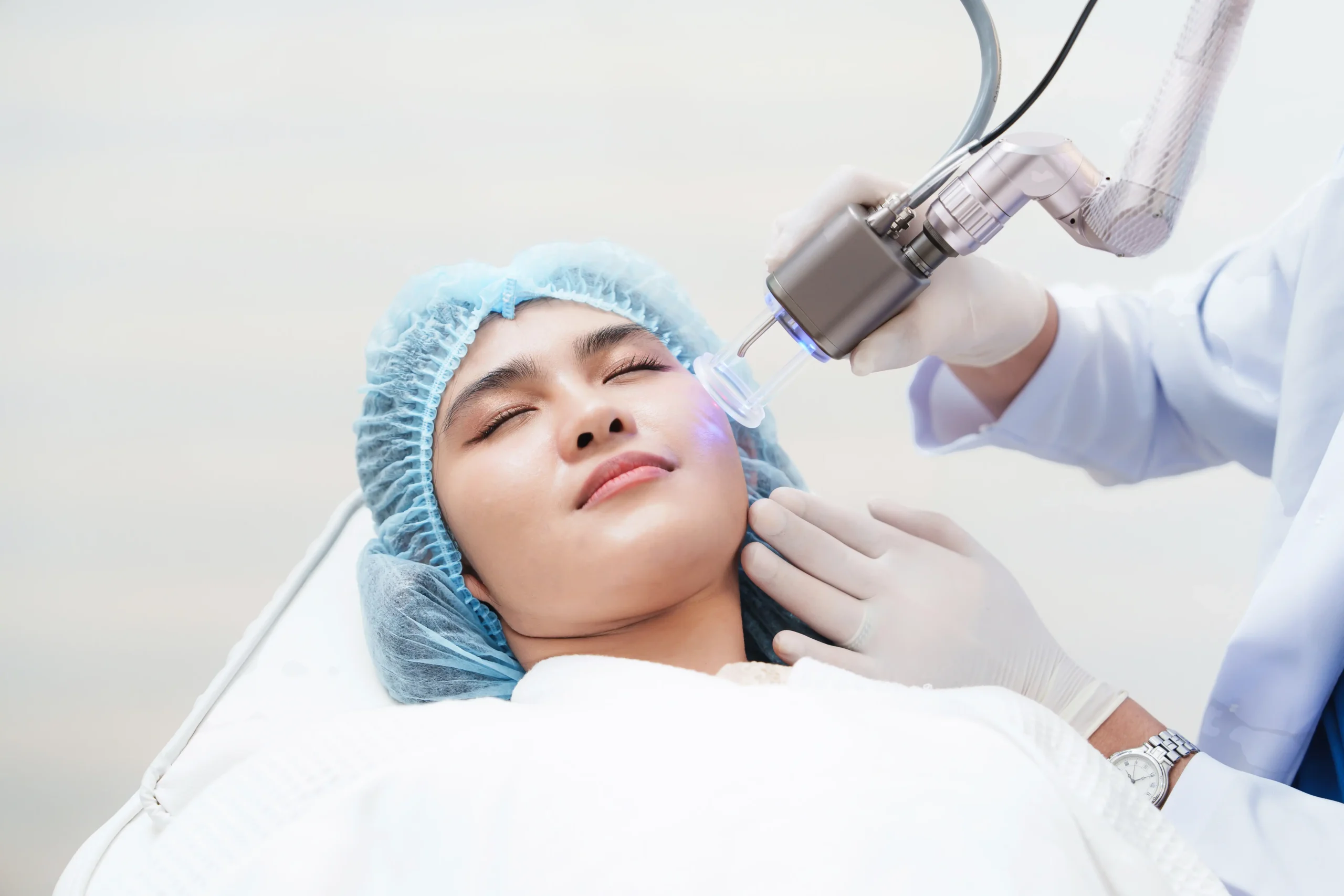 How Does Fraxel Laser Smooth Over Acne Scars? What to Expect for Clearer Skin 1 fraxel laser treatment scaled