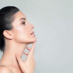 How to Keep Your Facelift Results Looking Fresh 1 Woman's profile with facial lifting lines drawn on cheek