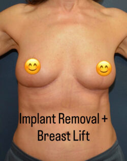 Breast Revision