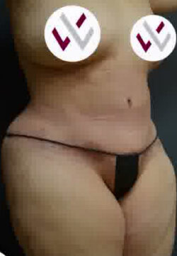 Abdominoplasty